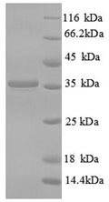 Recombinant Human CD59 glycoprotein (CD59) – Figure 1 of 1