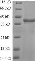 Recombinant Human T-cell antigen CD7 (CD7), partial – Figure 1 of 1