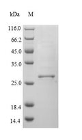 Recombinant Rat H-2 class II histocompatibility antigen gamma chain (Cd74), partial – Figure 1 of 1