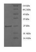 Recombinant Human CD81 antigen (CD81), partial – Figure 1 of 1