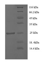 Recombinant Human CD81 antigen (CD81), partial – Figure 1 of 1