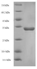Recombinant Bovine T-cell surface glycoprotein CD8 alpha chain (CD8A), partial – Figure 1 of 1