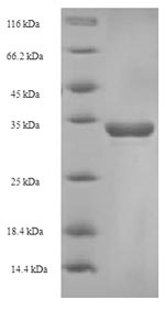 Recombinant Bovine T-cell surface glycoprotein CD8 alpha chain (CD8A), partial – Figure 1 of 1