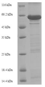 Recombinant Human Cadherin-1 (CDH1), partial – Figure 1 of 1