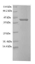 Recombinant Human Cyclin-dependent kinase 2-associated protein 1 (CDK2AP1) – Figure 1 of 1