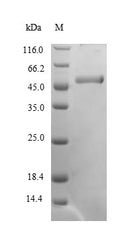 Recombinant Human Cyclin-dependent kinase 5 (CDK5) – Figure 1 of 1