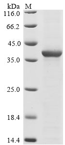 (Tris-Glycine gel) Discontinuous SDS-PAGE (reduced) with 5% enrichment gel and 15% separation gel.