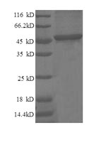 Recombinant Human Cyclin-dependent kinase inhibitor 1 (CDKN1A) – Figure 1 of 1