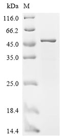 (Tris-Glycine gel) Discontinuous SDS-PAGE (reduced) with 5% enrichment gel and 15% separation gel.