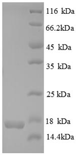 Recombinant Human CDKN2AIP N-terminal-like protein (CDKN2AIPNL) – Figure 1 of 1