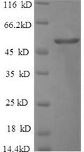 Recombinant Human Cerebellar degeneration-related protein 2 (CDR2) – Figure 1 of 1
