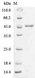 (Tris-Glycine gel) Discontinuous SDS-PAGE (reduced) with 5% enrichment gel and 15% separation gel.