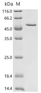 (Tris-Glycine gel) Discontinuous SDS-PAGE (reduced) with 5% enrichment gel and 15% separation gel.