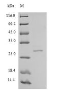 Recombinant Human Chymotrypsin-like elastase family member 2A (CELA2A) – Figure 1 of 1