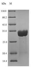Recombinant Human Centrin-2 (CETN2) – Figure 1 of 1