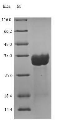 Recombinant Human Centrin-2 (CETN2) – Figure 1 of 1