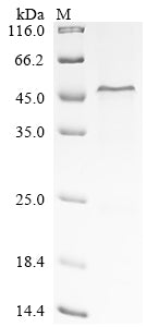 (Tris-Glycine gel) Discontinuous SDS-PAGE (reduced) with 5% enrichment gel and 15% separation gel.