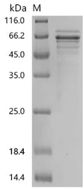 Recombinant Human Chromogranin-A (CHGA) – Figure 1 of 1