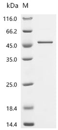 (Tris-Glycine gel) Discontinuous SDS-PAGE (reduced) with 5% enrichment gel and 15% separation gel.