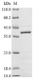 (Tris-Glycine gel) Discontinuous SDS-PAGE (reduced) with 5% enrichment gel and 15% separation gel.