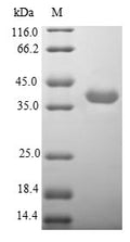 (Tris-Glycine gel) Discontinuous SDS-PAGE (reduced) with 5% enrichment gel and 15% separation gel.