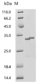 (Tris-Glycine gel) Discontinuous SDS-PAGE (reduced) with 5% enrichment gel and 15% separation gel.