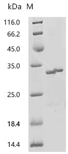 (Tris-Glycine gel) Discontinuous SDS-PAGE (reduced) with 5% enrichment gel and 15% separation gel.
