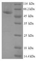 Recombinant Human Probable cytosolic iron-sulfur protein assembly protein CIAO1 (CIAO1) – Figure 1 of 1