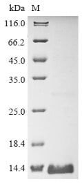 (Tris-Glycine gel) Discontinuous SDS-PAGE (reduced) with 5% enrichment gel and 15% separation gel.