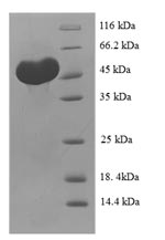 Recombinant Human C-type lectin domain family 18 member A (CLEC18A) – Figure 1 of 1
