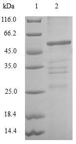 (Tris-Glycine gel) Discontinuous SDS-PAGE (reduced) with 5% enrichment gel and 15% separation gel.