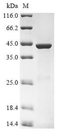 (Tris-Glycine gel) Discontinuous SDS-PAGE (reduced) with 5% enrichment gel and 15% separation gel.