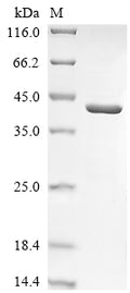 (Tris-Glycine gel) Discontinuous SDS-PAGE (reduced) with 5% enrichment gel and 15% separation gel.