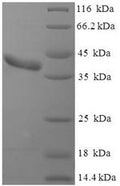 Recombinant Mouse Clathrin light chain A (Clta) – Figure 1 of 1