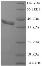 Recombinant Mouse Clathrin light chain A (Clta) – Figure 1 of 1