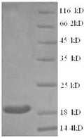 Recombinant Human Clathrin heavy chain 2 (CLTCL1), partial – Figure 1 of 1