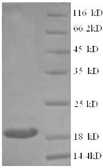 Recombinant Human Clathrin heavy chain 2 (CLTCL1), partial – Figure 1 of 1