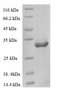 Recombinant Human Cellular nucleic acid-binding protein (CNBP) – Figure 1 of 1