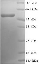 Recombinant Human Calponin-1 (CNN1) – Figure 1 of 1