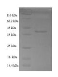 Recombinant Human Calponin-3 (CNN3), partial – Figure 1 of 1