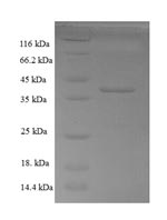 Recombinant Human Calponin-3 (CNN3), partial – Figure 1 of 1