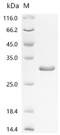 (Tris-Glycine gel) Discontinuous SDS-PAGE (reduced) with 5% enrichment gel and 15% separation gel.