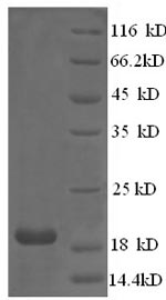 Recombinant Chicken Collagen alpha-1 (XII) chain (COL12A1), partial – Figure 1 of 1