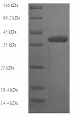 Recombinant Human Collagen alpha-1 (IV) chain (COL4A1), partial