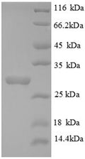 Recombinant Human Collagen alpha-3 (IV) chain (COL4A3), partial – Figure 1 of 1