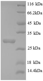 Recombinant Human Collagen alpha-3 (IV) chain (COL4A3), partial – Figure 1 of 1