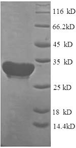 Recombinant Human Cytochrome c oxidase subunit 4 isoform 1, mitochondrial (COX4I1) – Figure 1 of 1
