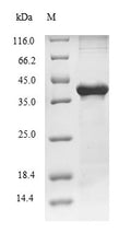 (Tris-Glycine gel) Discontinuous SDS-PAGE (reduced) with 5% enrichment gel and 15% separation gel.