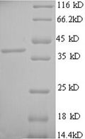Recombinant Human Mast cell carboxypeptidase A (CPA3) – Figure 1 of 1