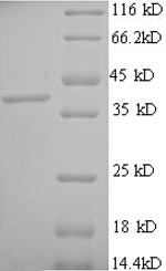 Recombinant Human Mast cell carboxypeptidase A (CPA3) – Figure 1 of 1